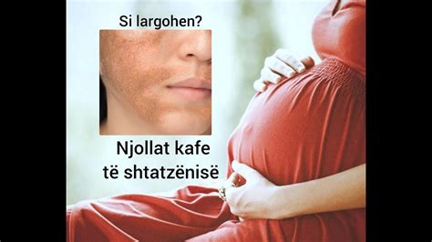 Pavarësisht nëse jeni shtatzënë apo jo, në raste shumë të rralla shkarkimi ngjyrë <b>kafe</b> mund të jetë një shenjë e çështjeve më serioze – një abort i afërt , shtatzëni ektopike , probleme me placentën ose një shenjë e një infeksioni të qafës së mitrës ose mitrës (megjithëse këto këto kushte. . Gjakderdhje ne shtatzani ngjyre kafe